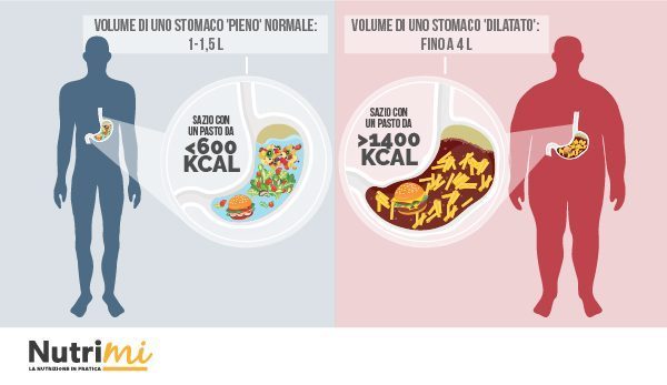 Esemplificazione del volume gastrico di soggetti normopeso e obesi a confronto